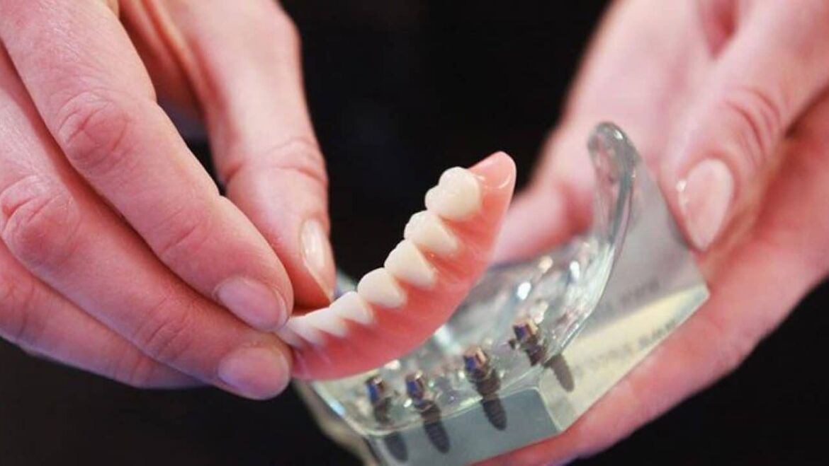 Snap-On Dentures or Implant Dentures