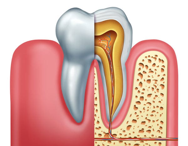 What is a root canal therapy?