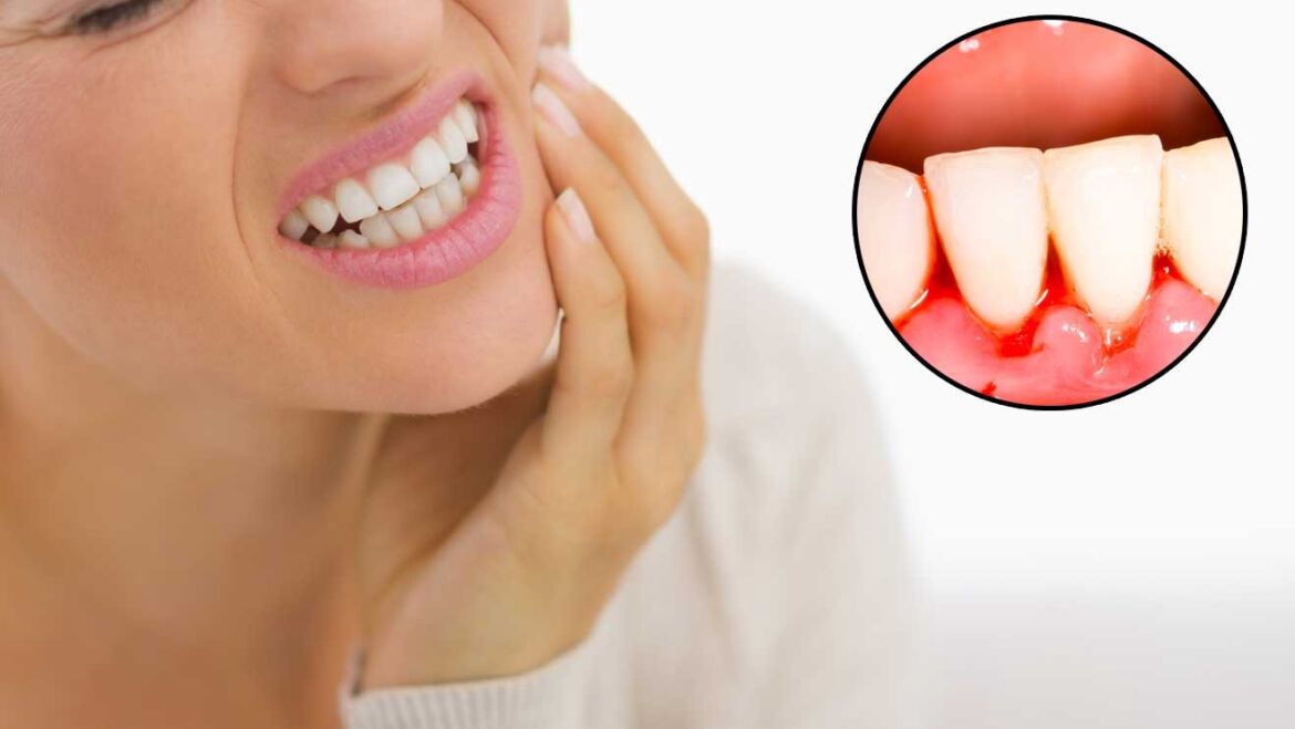 Best dental treatment for bleeding gums in Broward