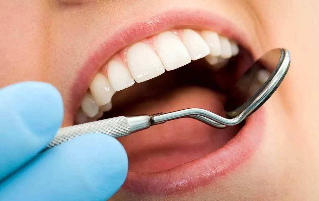 Teeth restoration at Affordable Dentistry of Coral Springs