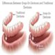 Exploring Different Types of Dentures: Understanding the Variations