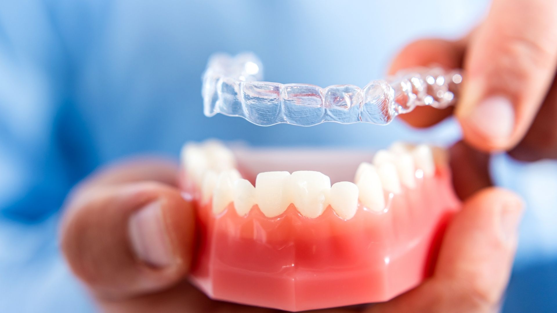All-about-clear-aligners-and-invisible-braces