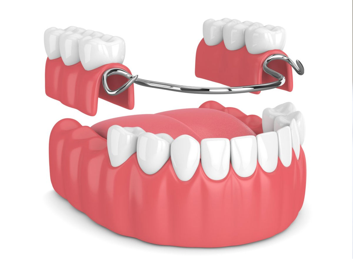 Full-Partial-Dentures