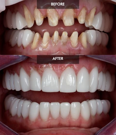 before-and-after-47